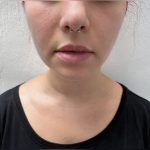lobe lobepiercing piercingstudio ear earpiercing earpiercings piercingaddict piercingjewelry piercingshop piercinggirl piercer instapiercing piercedgirl lovepiercings piercingspecial pierced piercedgirl piercingday budapest septum 7