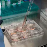 L'Immunothérapie : Une Avancée Majeure en Cancérologie