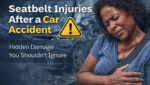 seatbelt injuries after car accident showing chest bruising and pain from seatbelt restraint