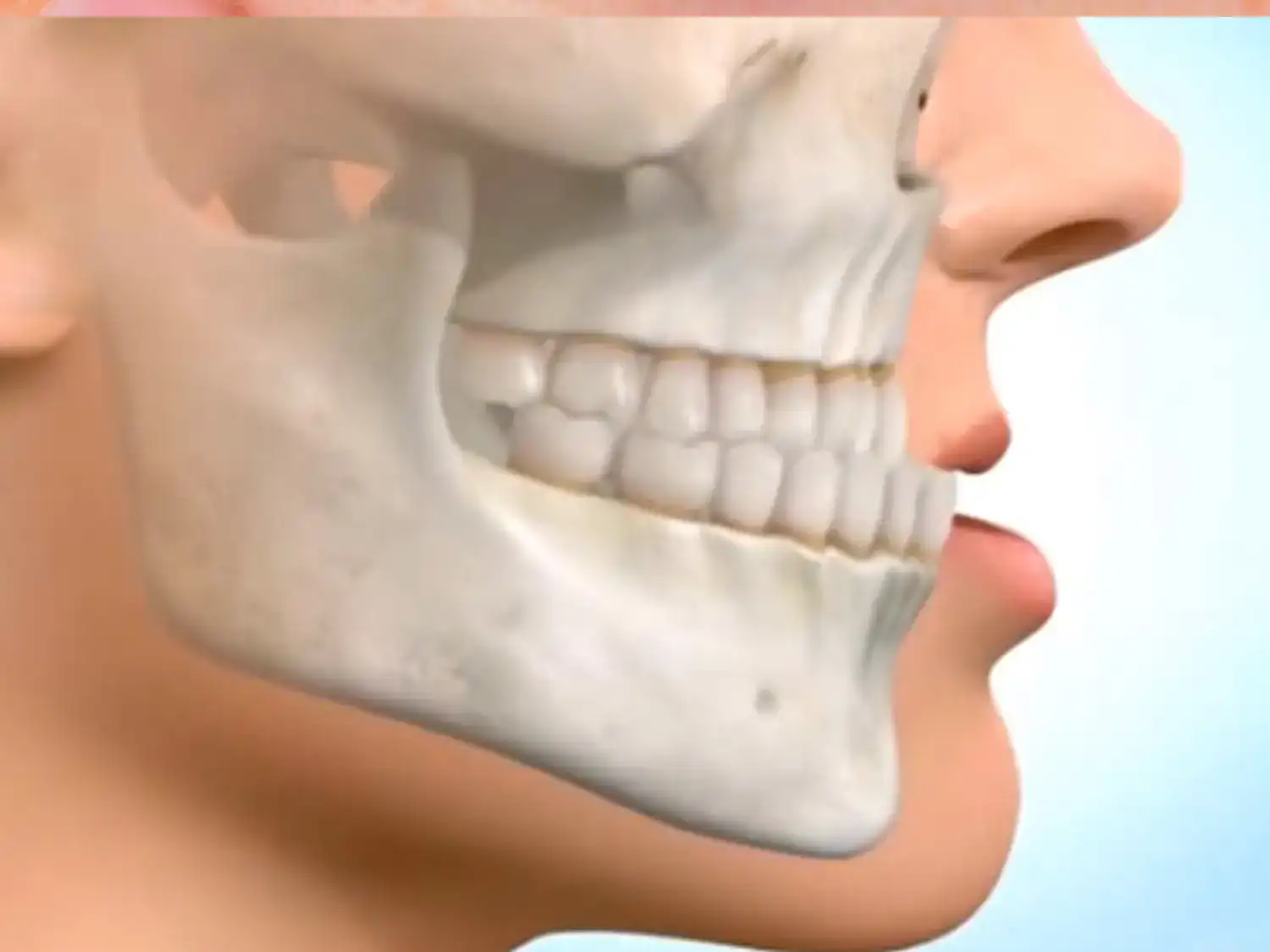 علاج انزلاق غضروف الفك