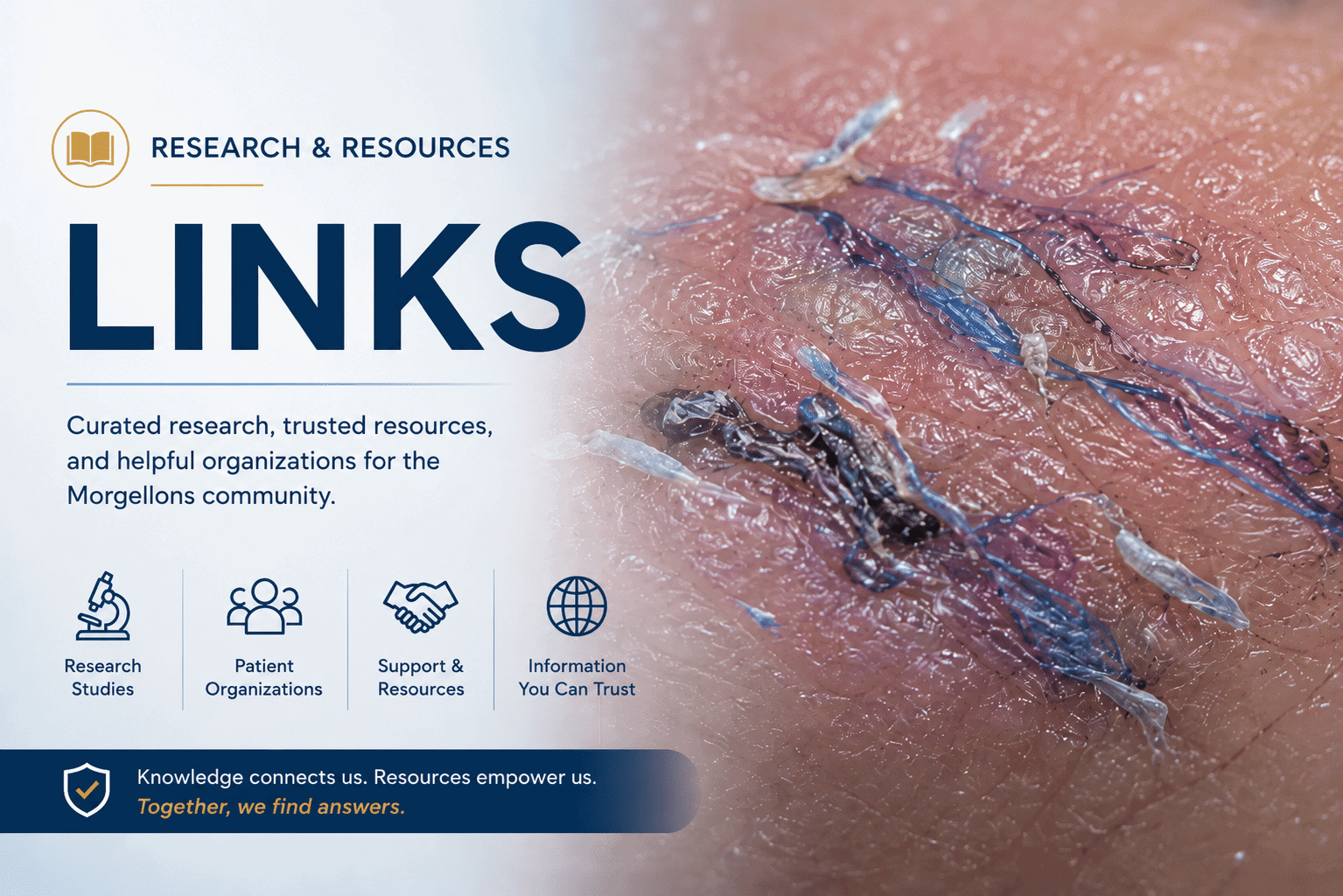 Research and resources banner for Morgellons showing embedded flattened blue fibers in skin beside the heading “Links.”