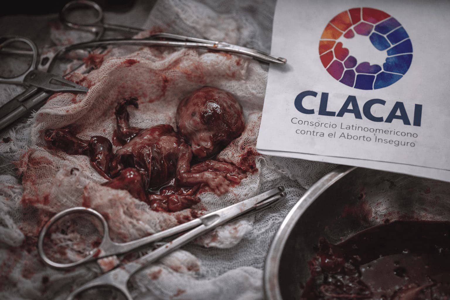 Red abortista CLACAI