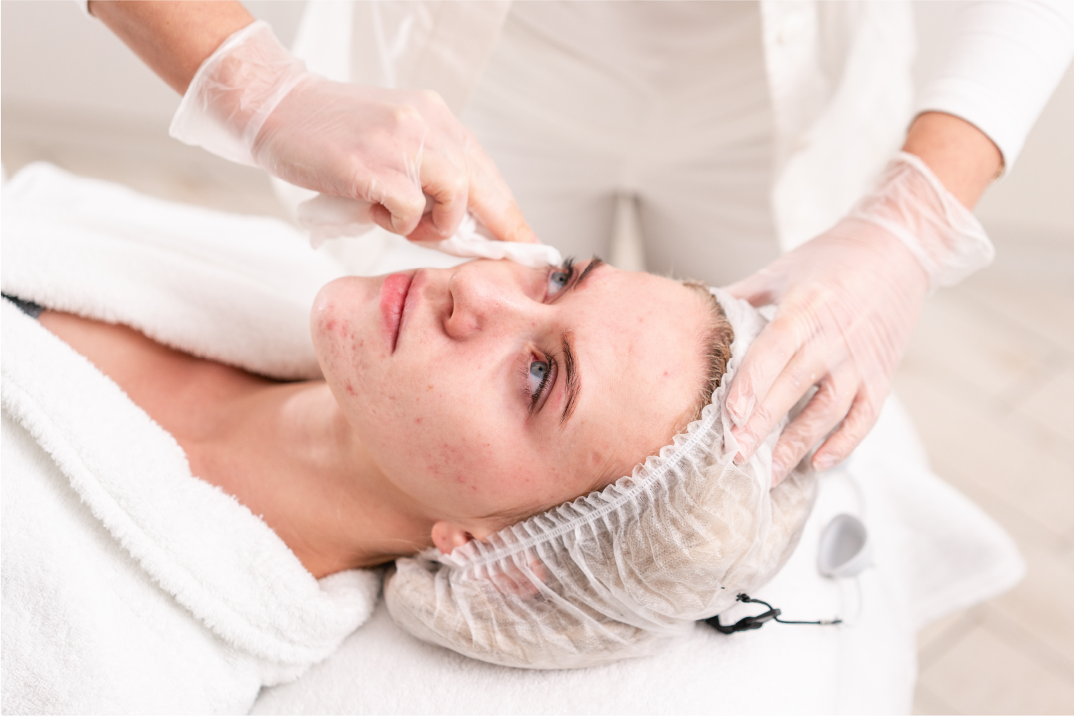 Mesotherapy treatment for scars