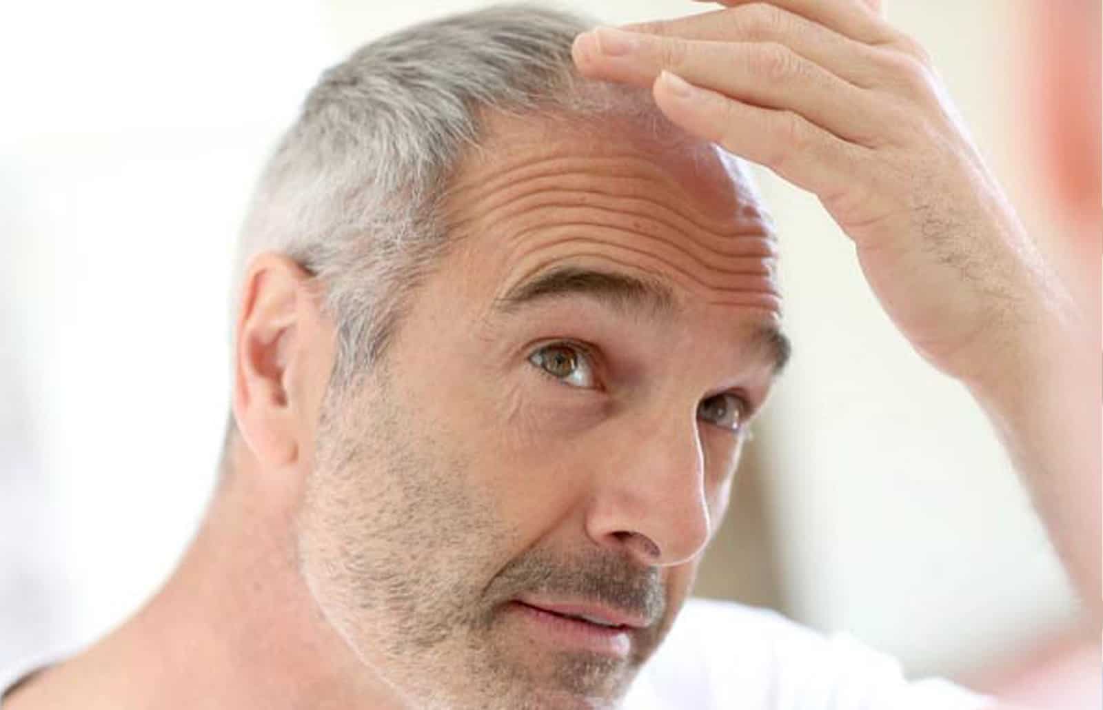 Zinc Thymulin for Hair Loss Treatment. Hair Loss Treatment. Hair Rejuvenation Treatment.