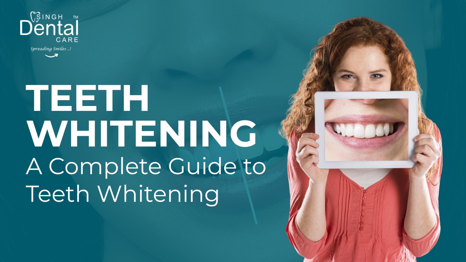 teeth whitening