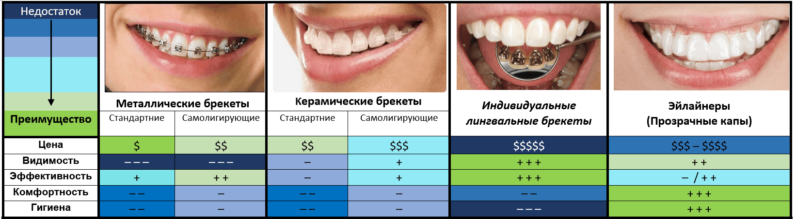 сравнение брекеты