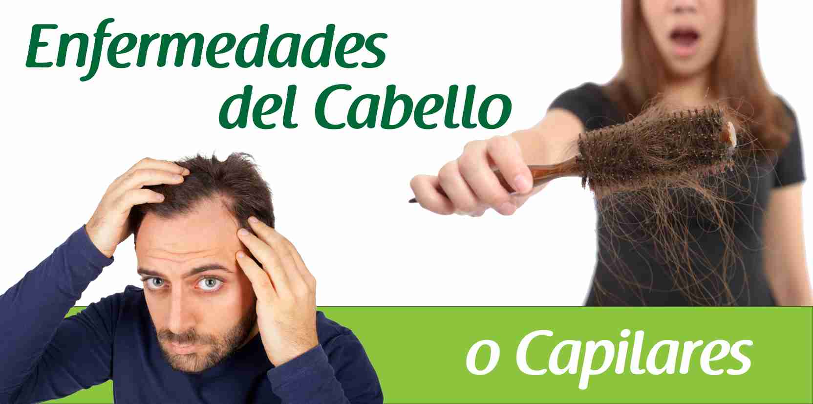 Enfermedades del cabello o capilares caida, calvicie