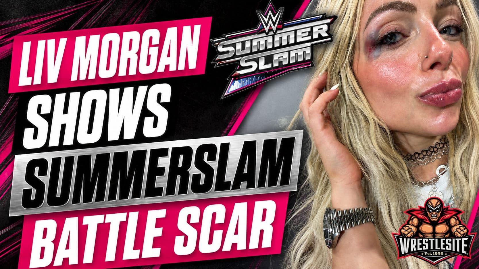 Liv Morgan displays bruising near her left eye after retaining the Women’s World Championship against Iyo Sky at WWE SummerSlam 2026