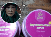 Warga Gowa Diduga Jadi Korban Skincare Berbahaya, Usai Pakai WR Glow Wajah Gatal dan Bengkak