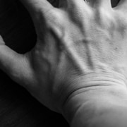 Ganglion cyst hand wrist surgery Austin TX ATX Orthopedics