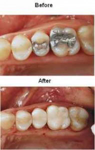 before_and_after-190x300