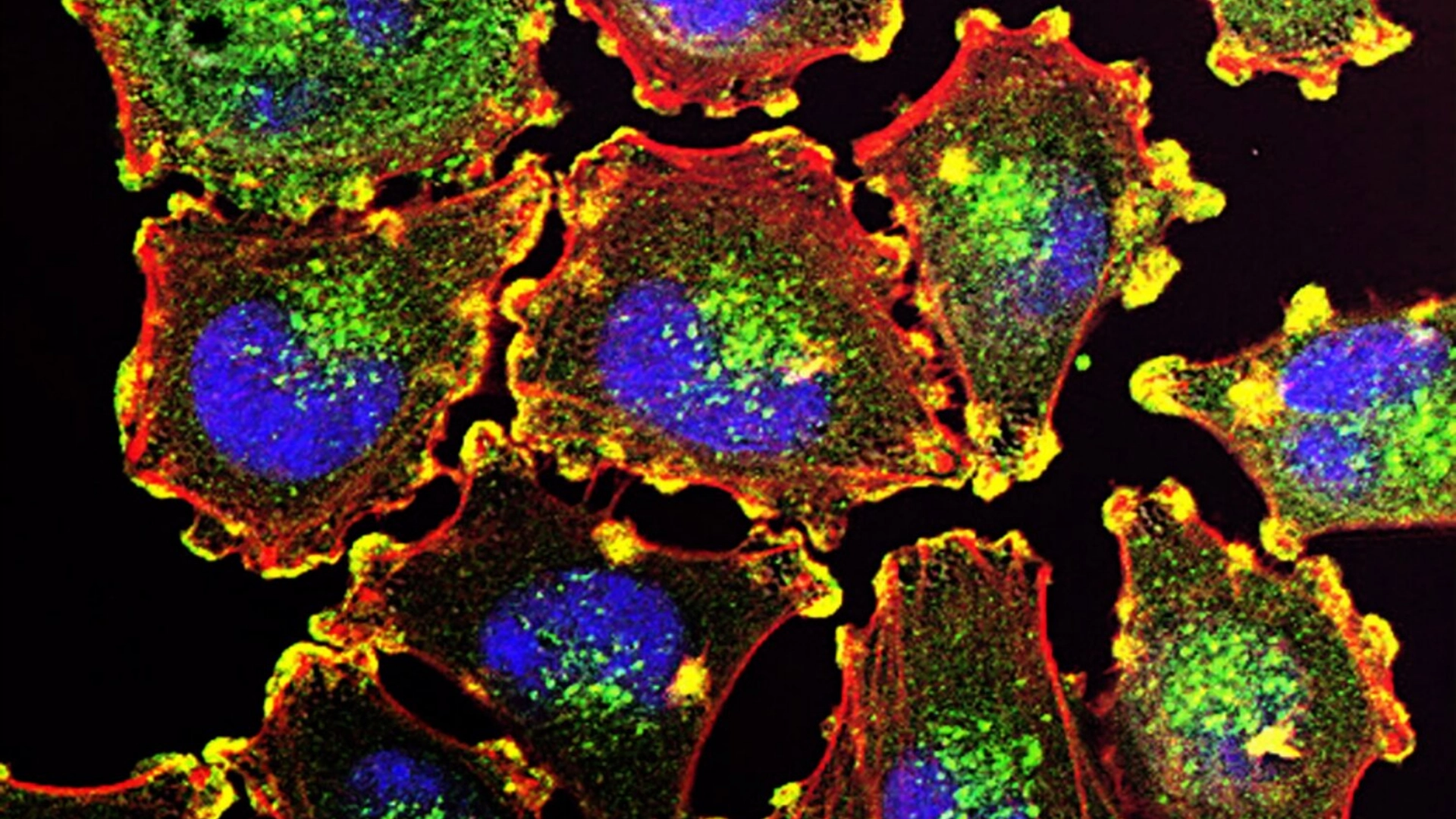 Cancer Metabolism