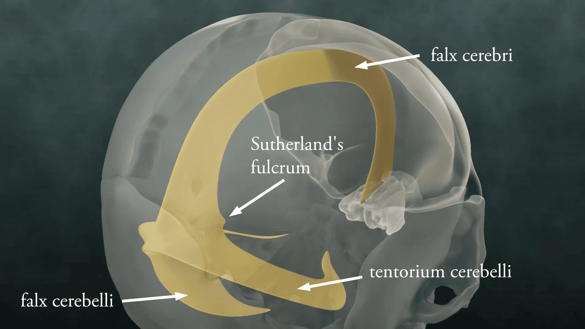 The falx cerebri and tentorium cerebelli highlighted within the cranium, showing their sickle shapes and meeting point at the straight sinus.