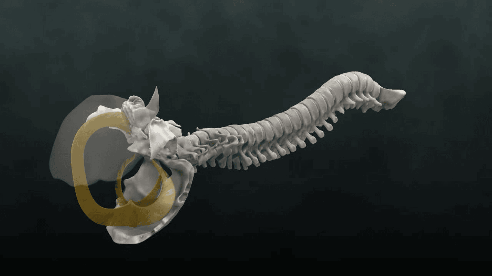 Close view of the dural attachments at the occiput and upper cervical spine, showing continuity between cranial and spinal membranes.