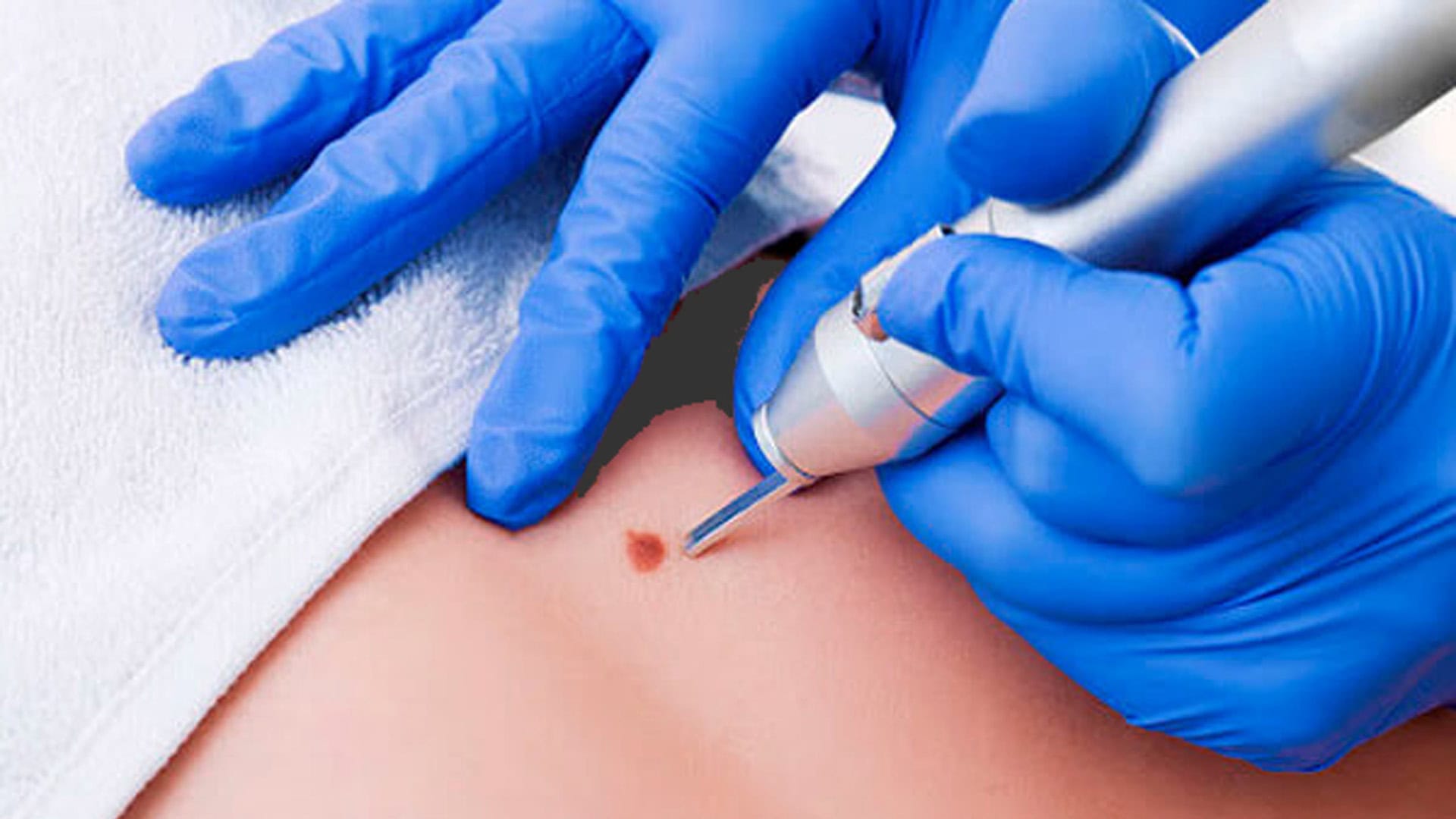 dermatologia-cirurgica-rj-tijuca