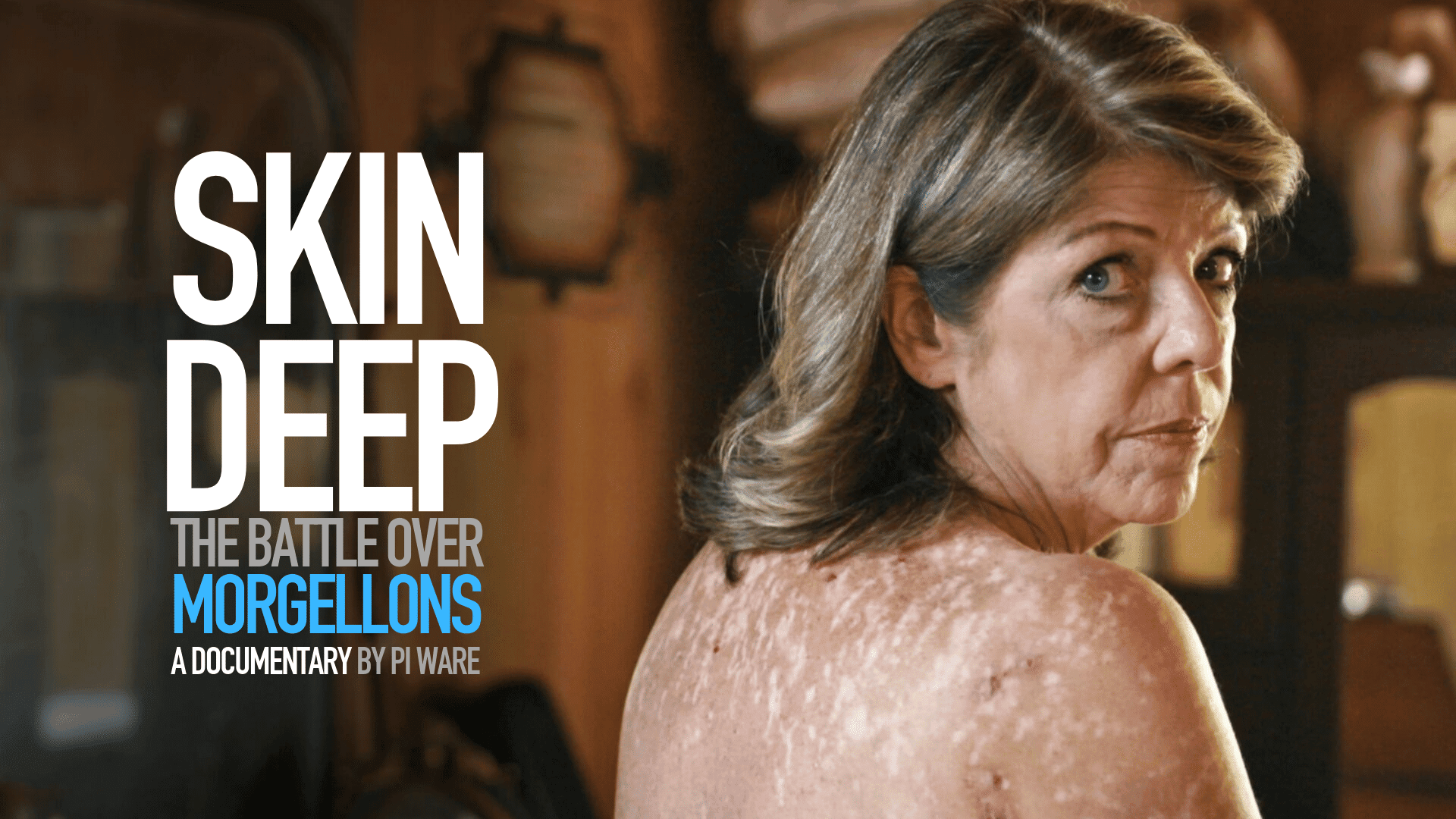 Skin Deep Morgellons Movie