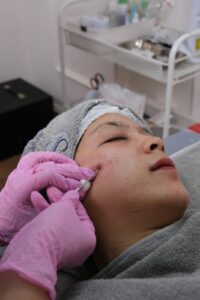 Advance Your Aesthetics Career with Microneedling Module & Skill Training Course in Regina