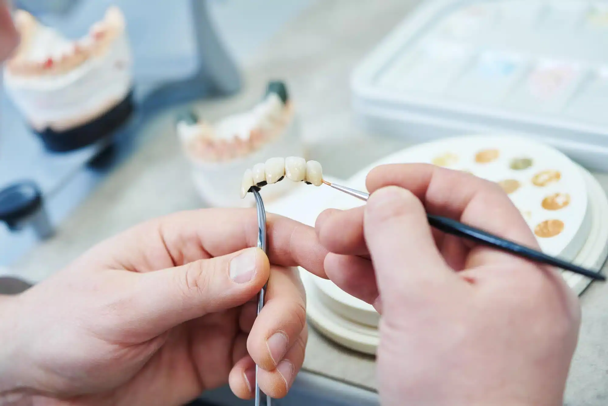 fixing-dental-bridges-in-riverview-mi