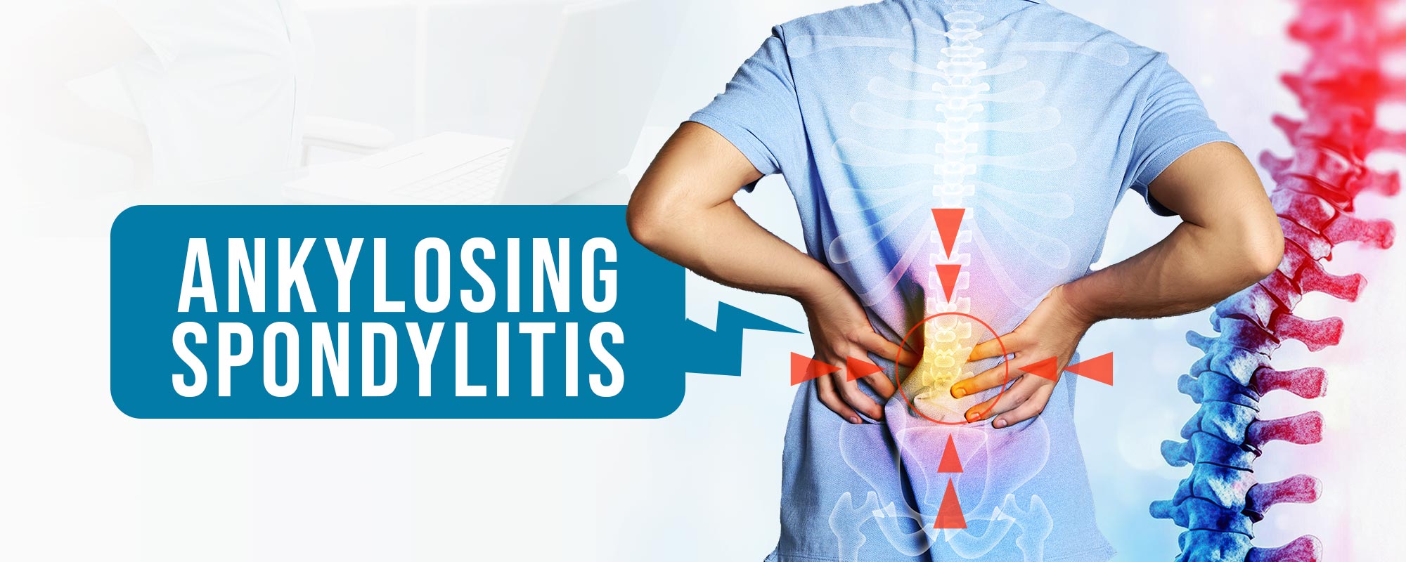 Homeopathy treatment for ankylosing spondylitis showing spine inflammation relief at Dr. Care Homeopathy clinic