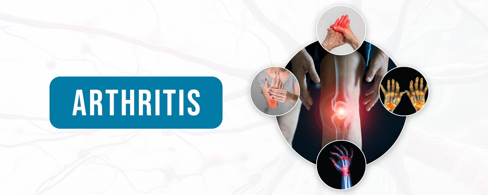 Homeopathic Treatment for Arthritis in Hyderabad - Dr Care