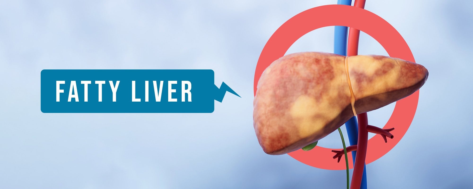 Fatty liver disease homeopathy treatment natural liver care