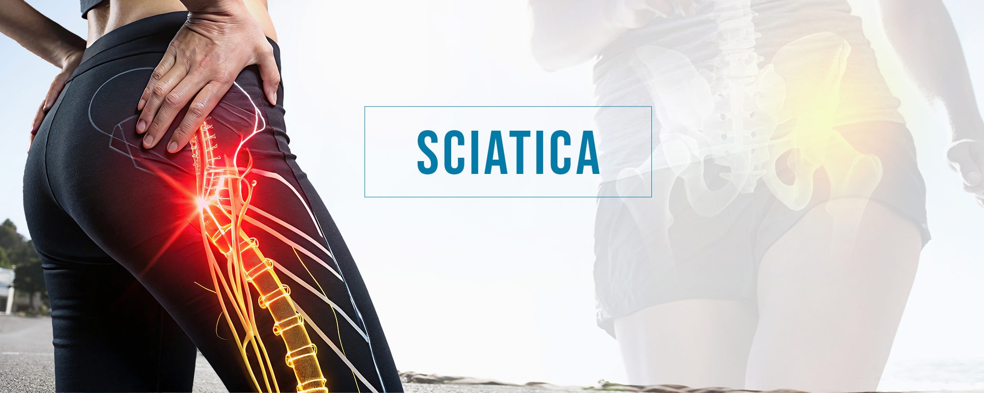 Homeopathy Treatment for Sciatica – Safe, Permanent & Surgery-Free Relief from Sciatic Nerve Pain