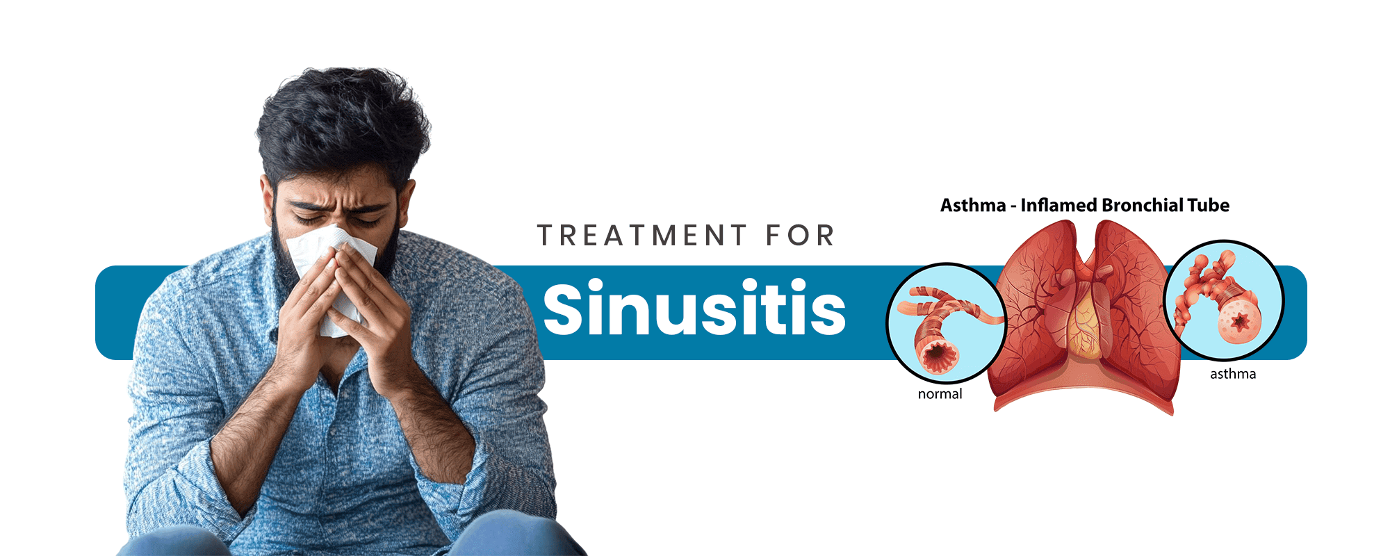 Homeopathy sinusitis treatment consultation and natural sinus relief