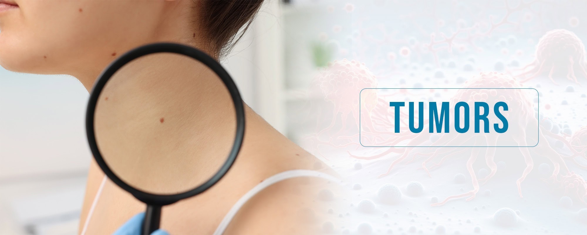 Homeopathy treatment for tumors at Dr. Care Homeopathy clinic