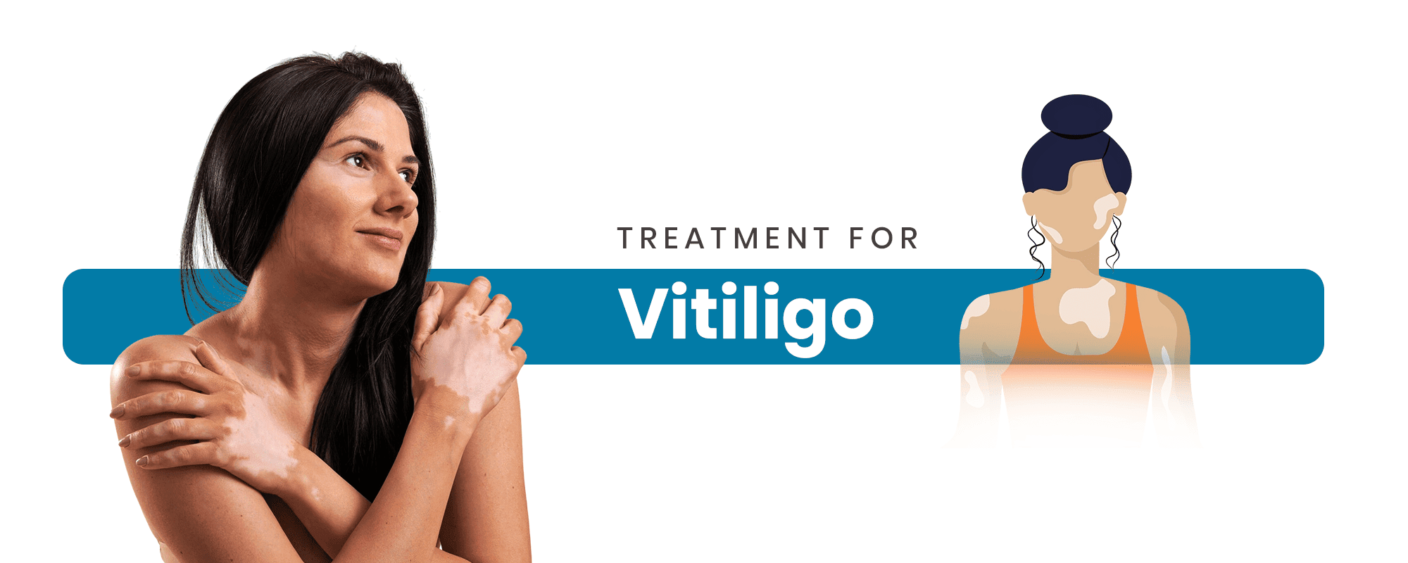 Homeopathy Treatment for Vitiligo – Natural White Patch & Pigmentation Restoration at Dr. Care Homeopathy