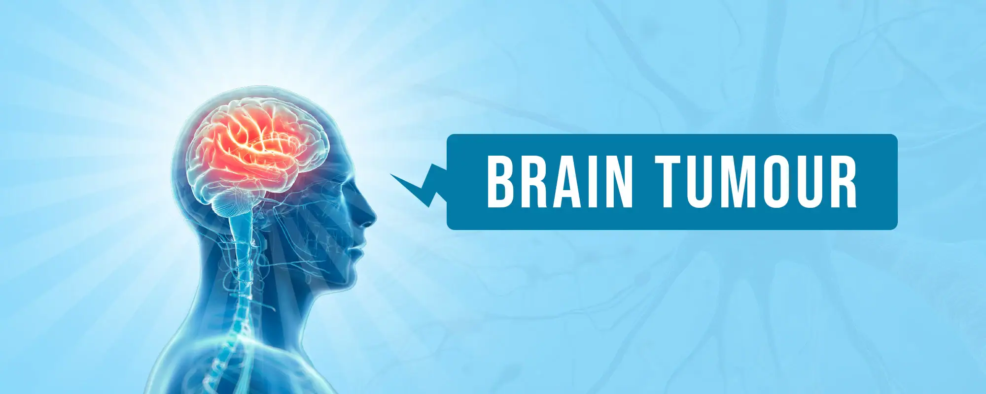 Brain-Tumour