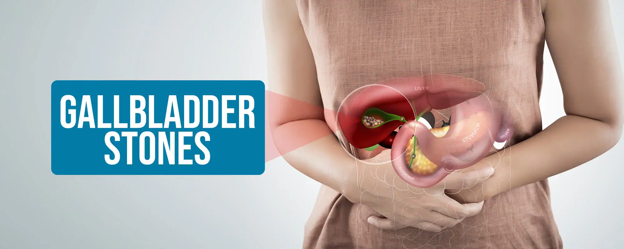 Gallbladder-Stones-Treatments
