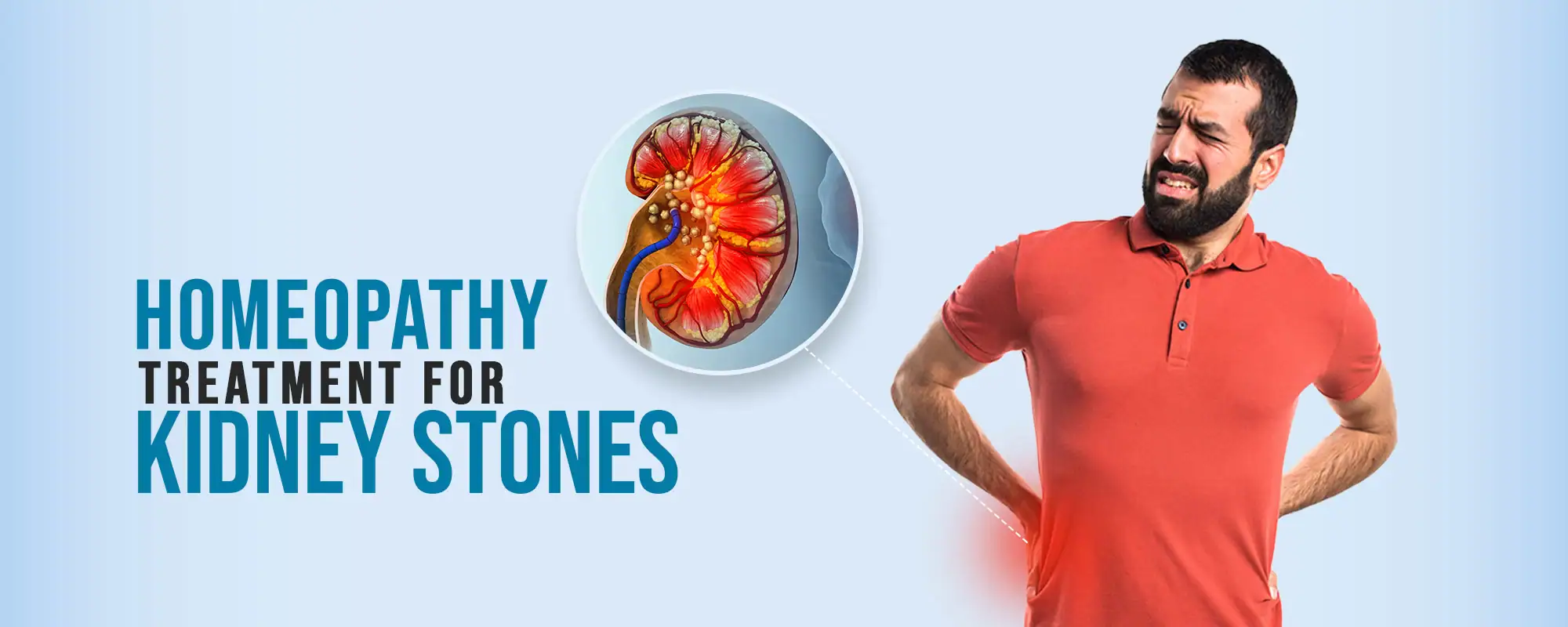 Kidney-Stones-Treatments
