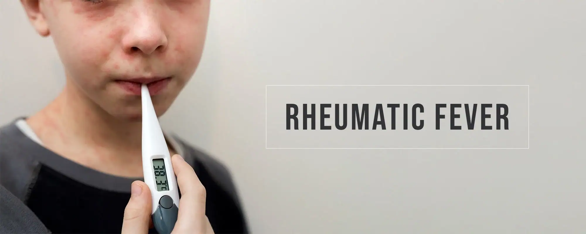 Rheumatic-Fever-Treatments