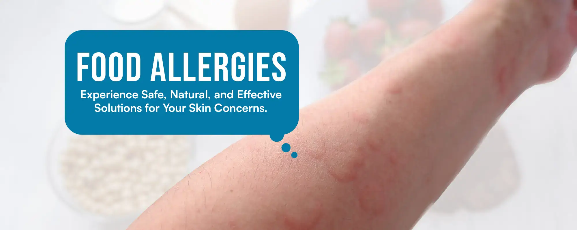 food-Allergies-Treatments