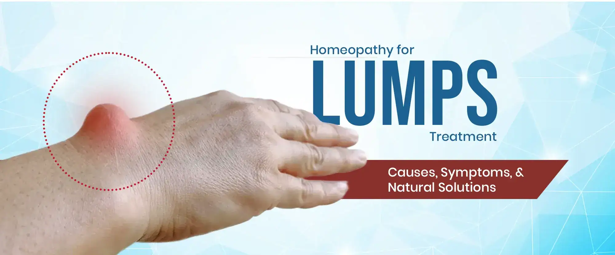 Lumps-Treatment