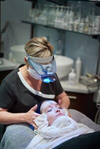 Chemical Peel Treatment in Regina to Reduce Post Winter Dullness and Dryness
