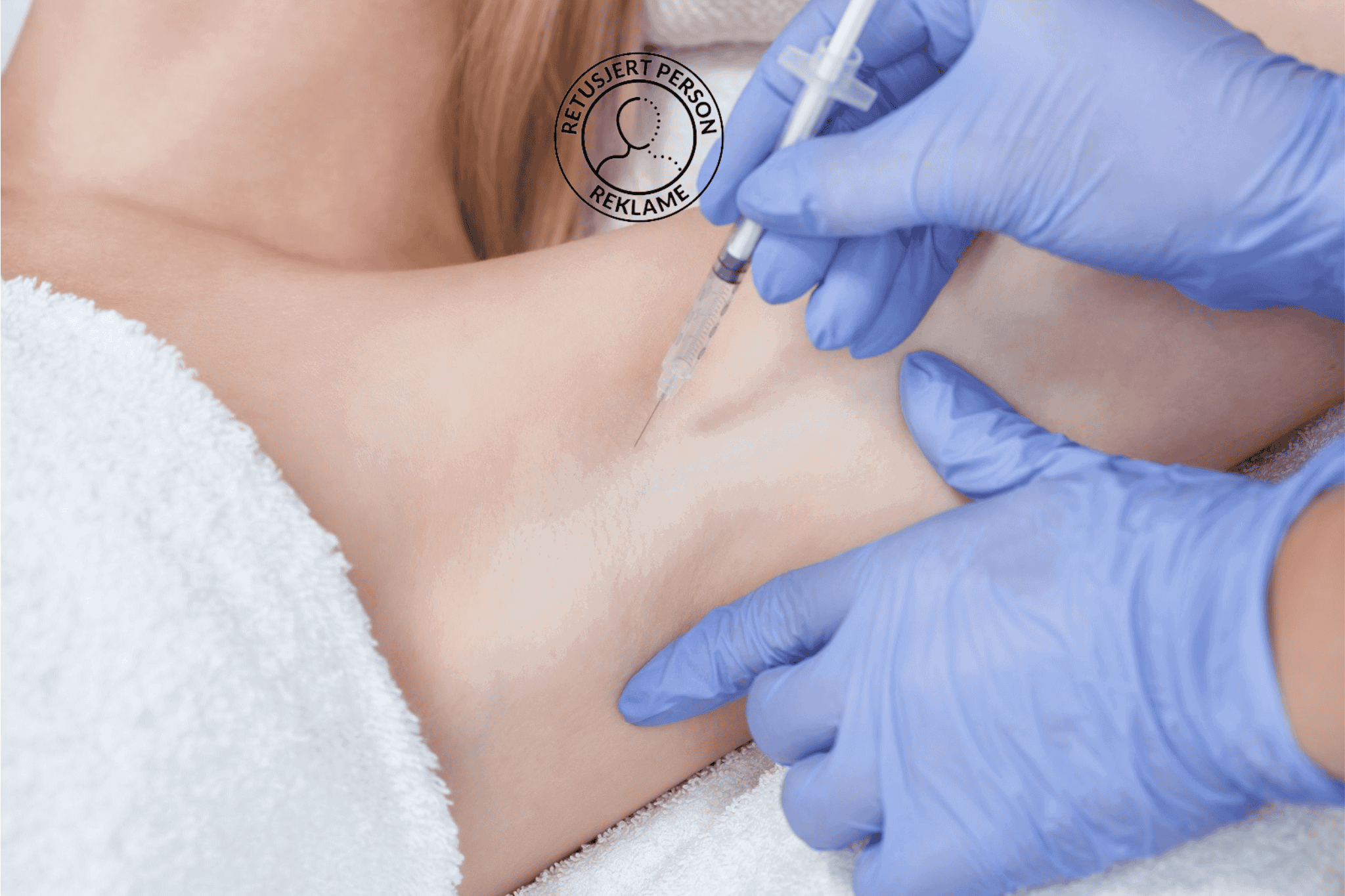 svettebehandling med botox