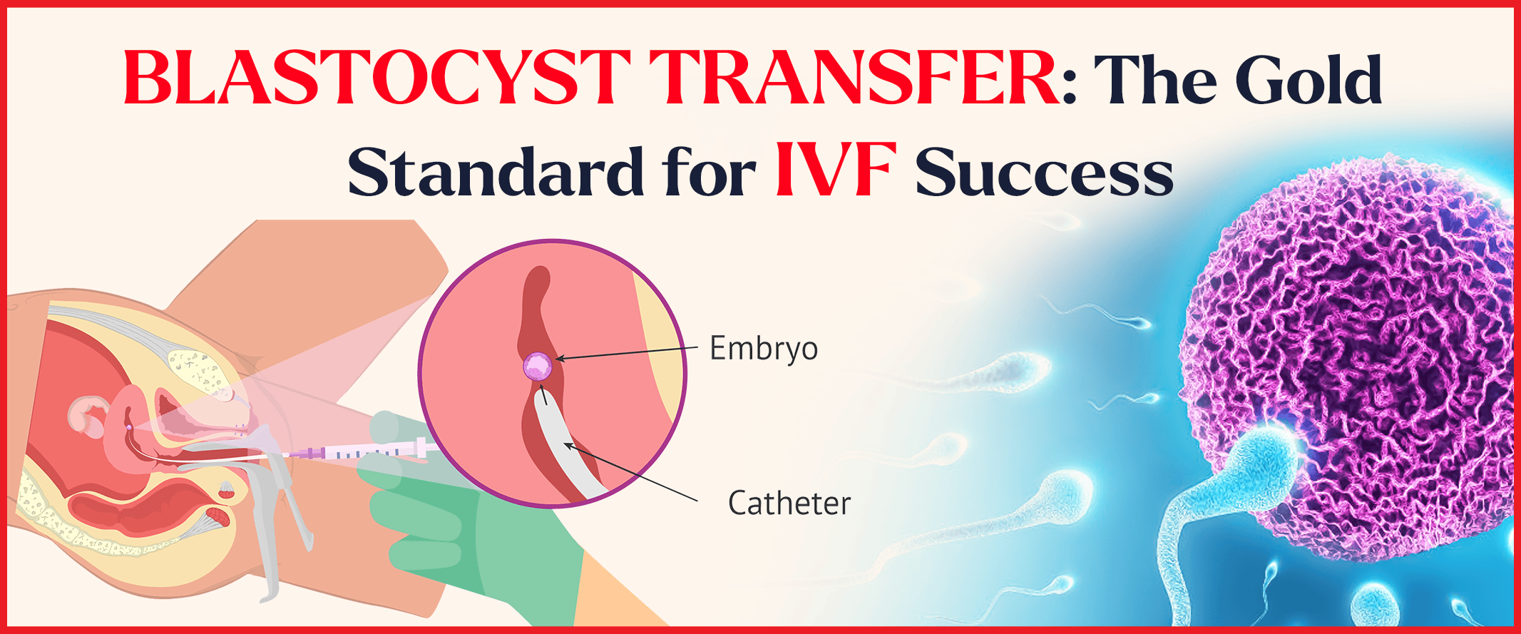 Blastocyst Culture And Transfer