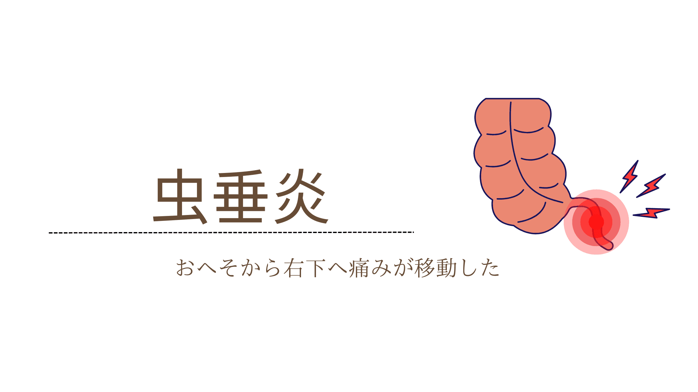 虫垂炎