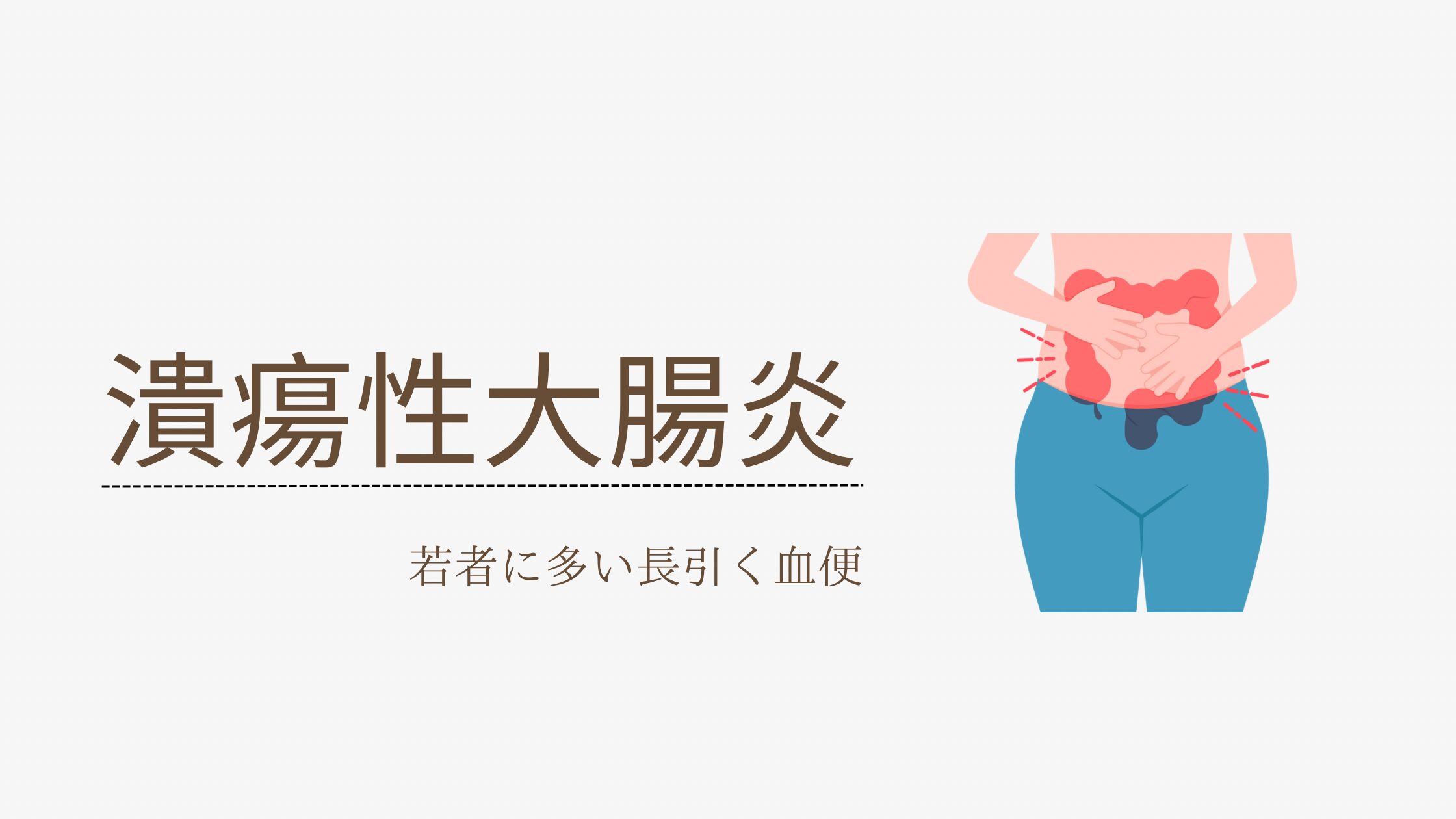 潰瘍性大腸炎