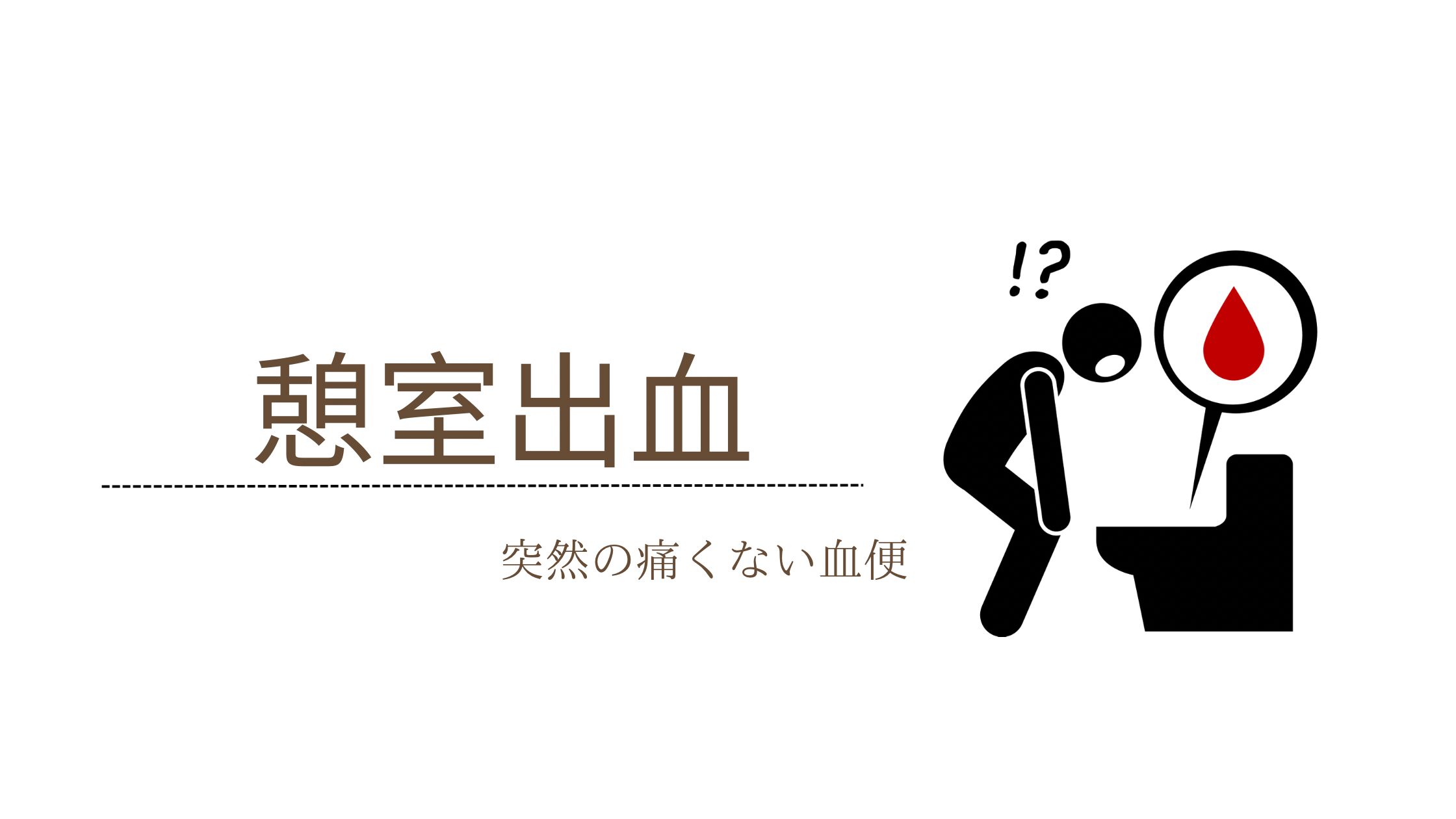 憩室出血とは