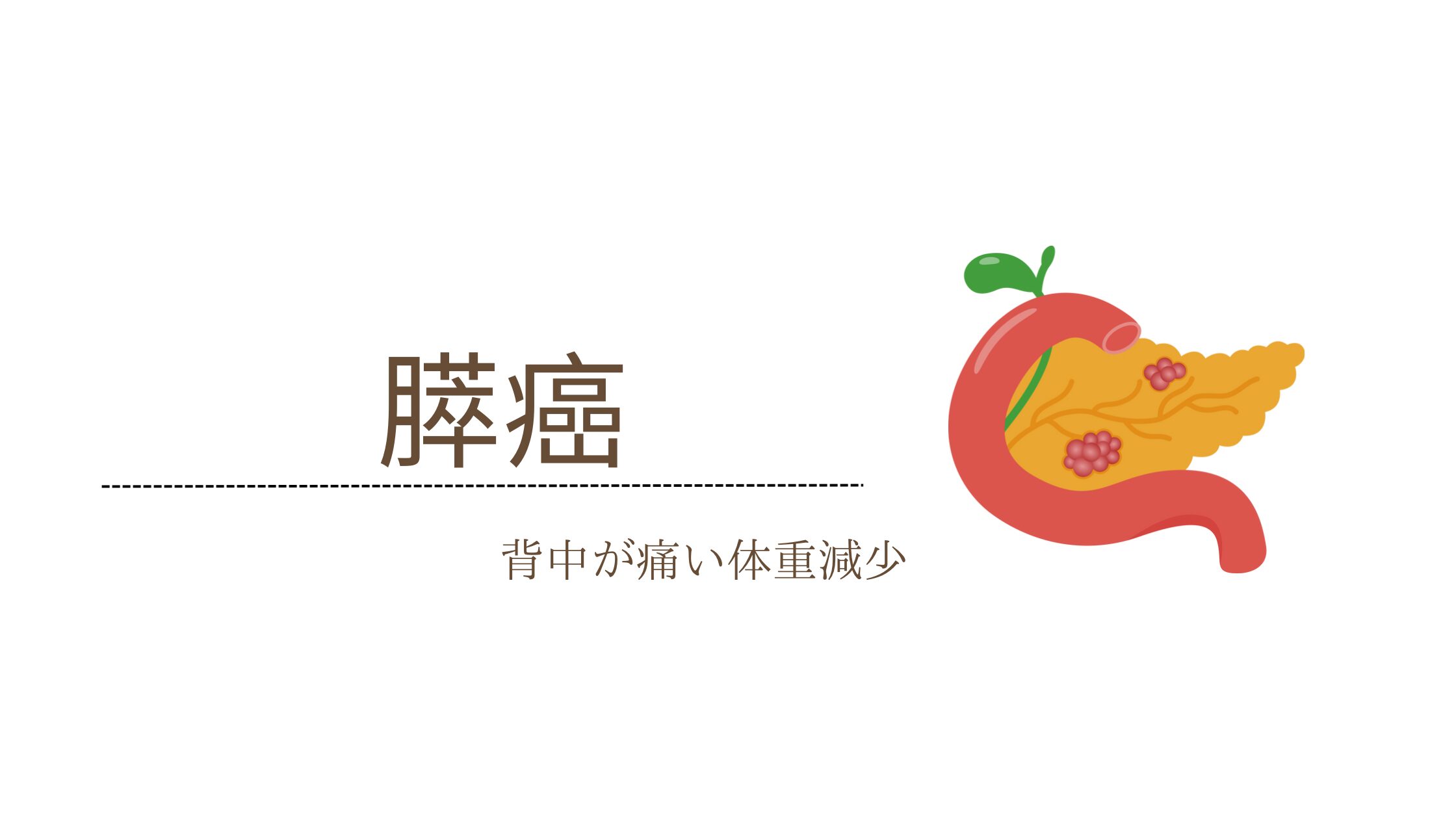 膵癌とは