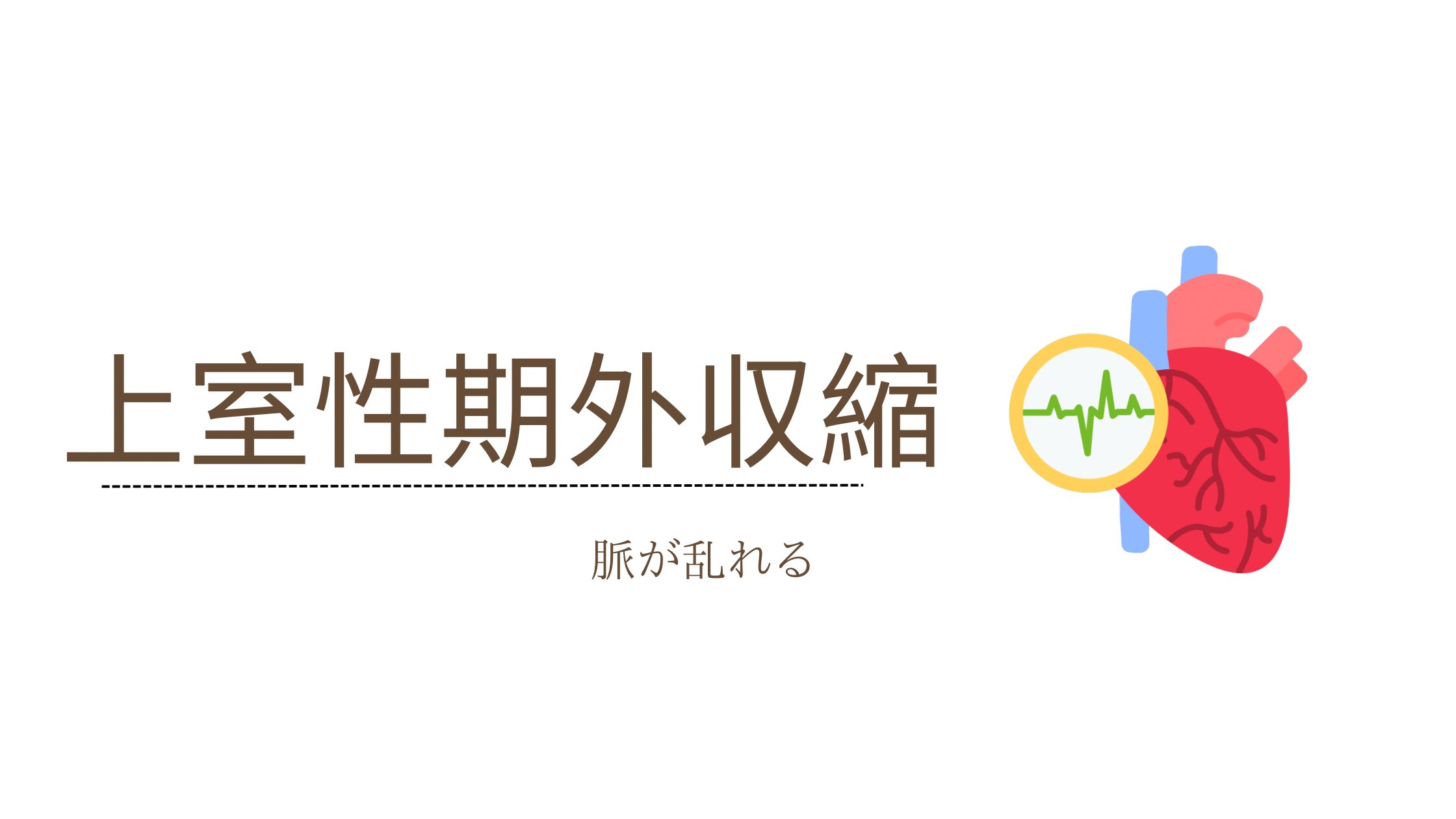 心室性期外収縮とは