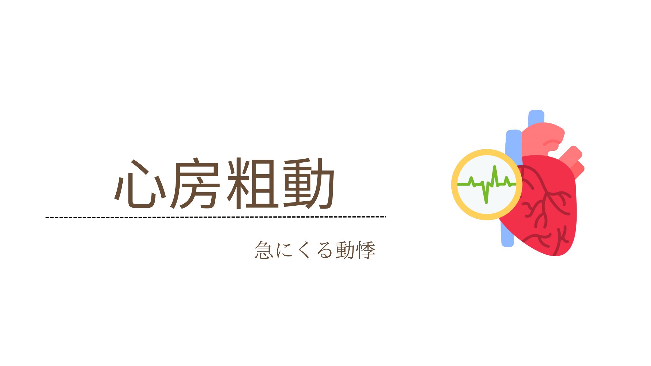 心房粗動について