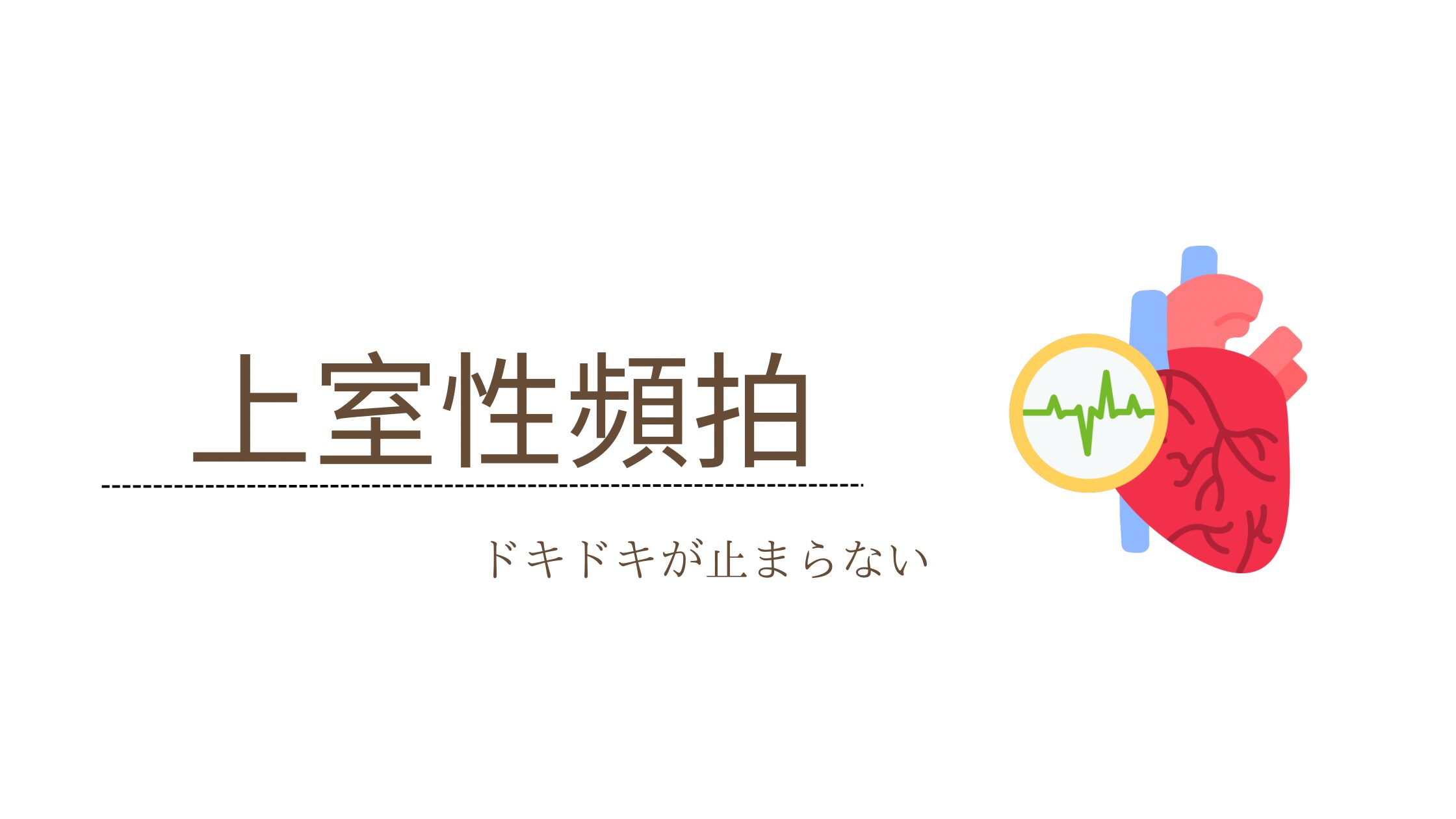 上室性頻拍