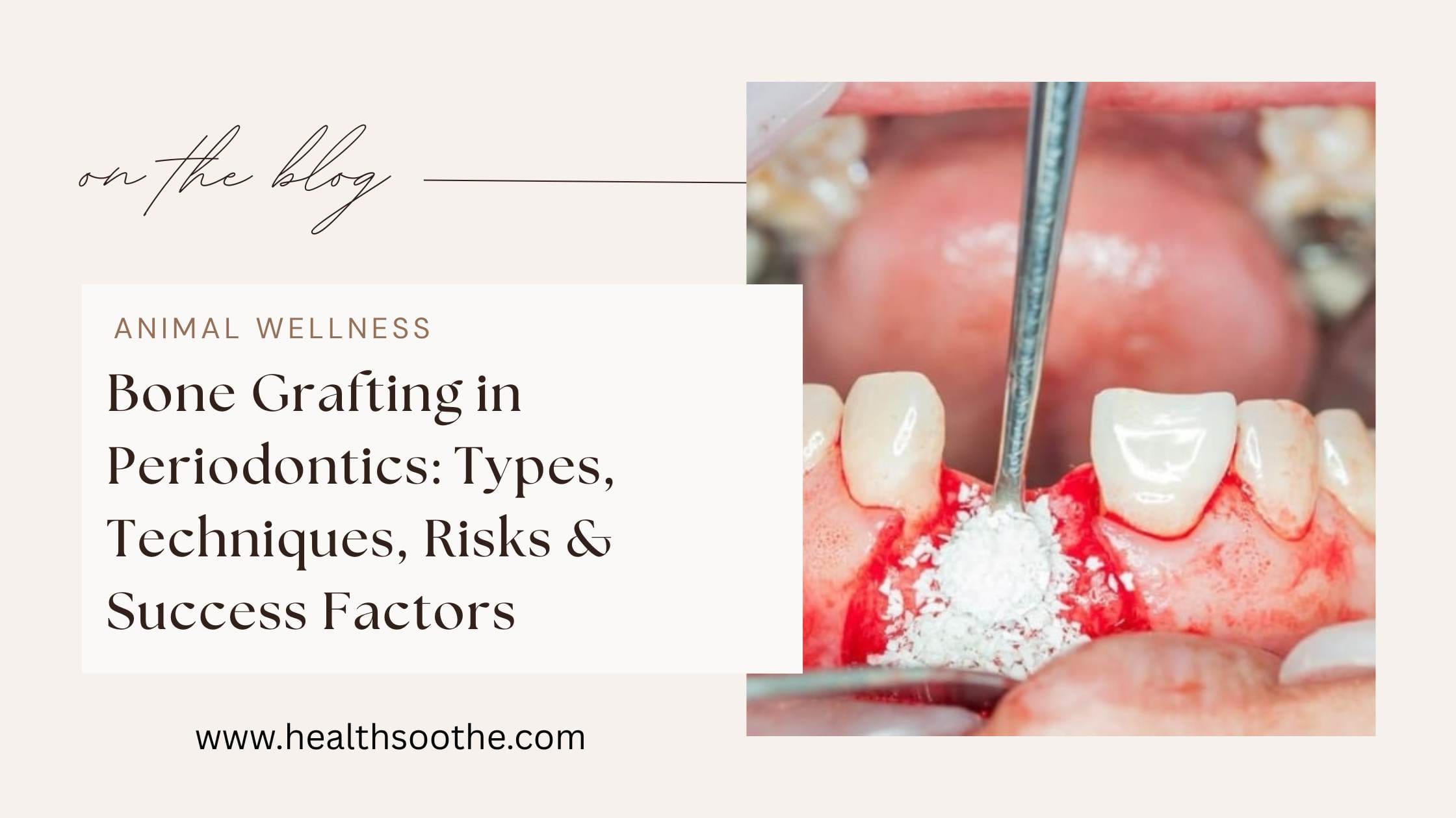 Bone Graft