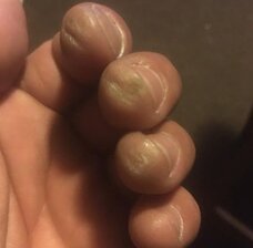 Finger