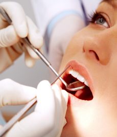 blanqueamiento-dental-1-e1540309315932