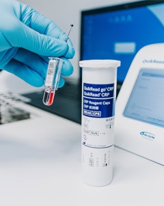Therapieansätze bei Hausstaubmilbenallergie Dr. Tzimas