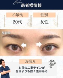 二重患者